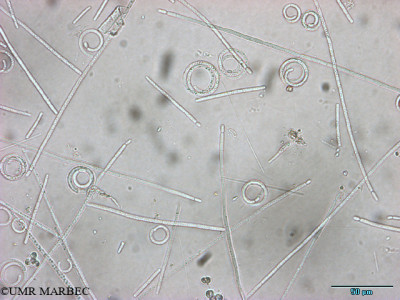 phyto/Mayotte/carriere/Retenues_collinaires_de_Mayotte  2006-2009/Planktolyngbya sp2 et Cylindrospermopsis sp (x40 Mayotte Carriere 60308.tif)(copy)_thumb.jpg